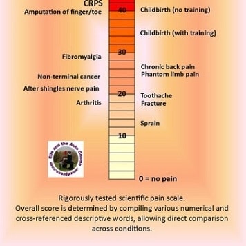 Cassylise's tweet photo. This crps flare needs to end! My face, neck, right hand, and left leg from hip to toes are throbbing, burning, and feeling heavy.I'm hot to the touch, &amp; clothes make my skin feel like it's either in barbed wire, sandpaper, or crawling with ants. Pain is unbearable 😭😤 #CRPSsucks https://t.co/2K6PSPUX9A