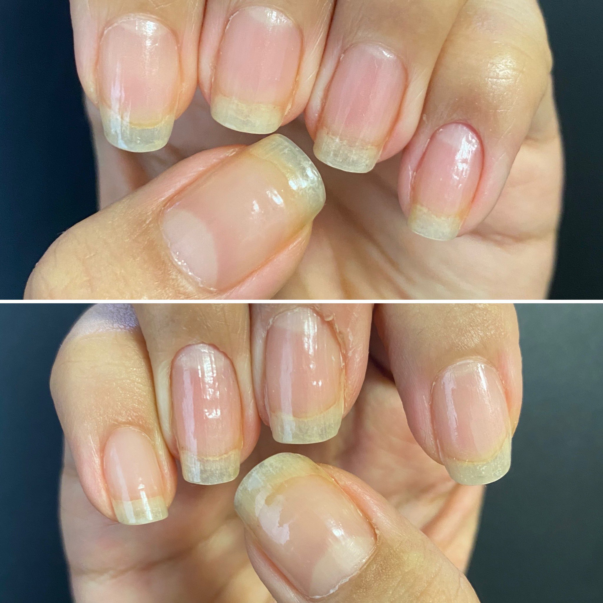 うにon Twitter 21年7月29日爪育成280日目https T Co Y8sbcwlzb0 Twitter