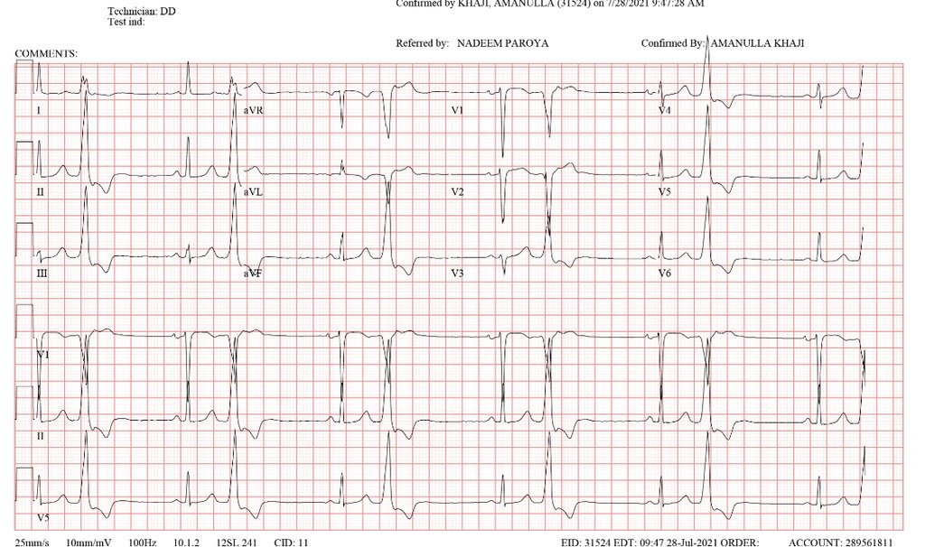 Soo?#epeeps