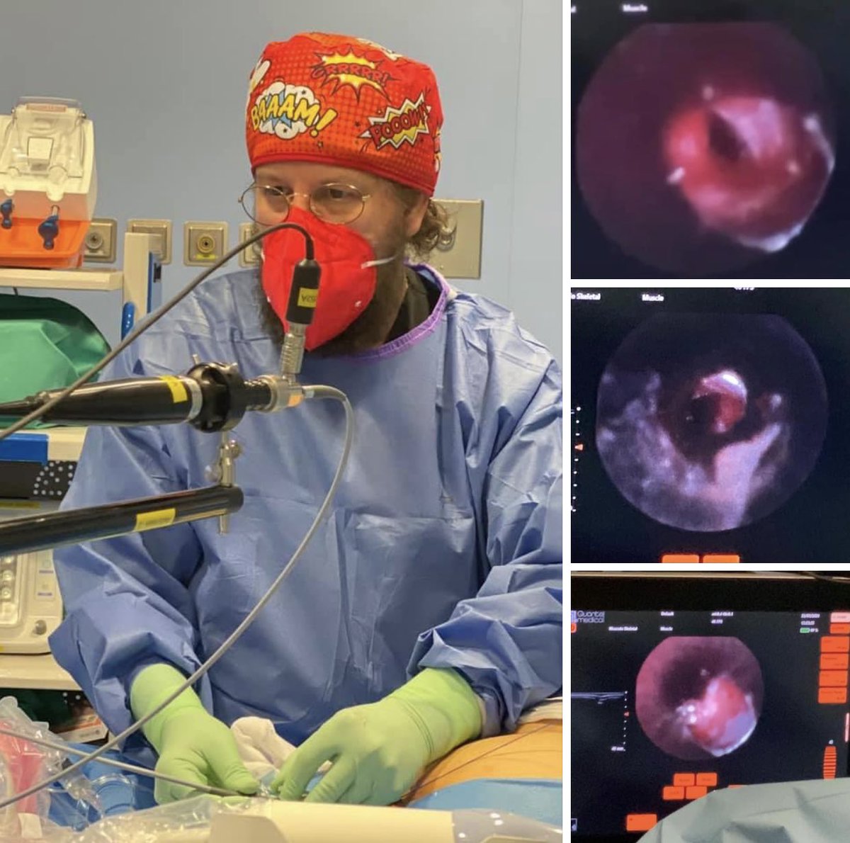 To see or not to see, that’s the question !!! 
The Next Revolution in Pain Management.
.
Micro-Endoscope 7SS
7 STAR SCOPE 
.
Pain Management Unit 
<a href="/Vithas/">Vithas Hospitales</a> Madrid La Milagrosa Hospital #madrid #chamberi #7SScidranes #7starscope #7starscopemadrid #painmanagement #painrelief