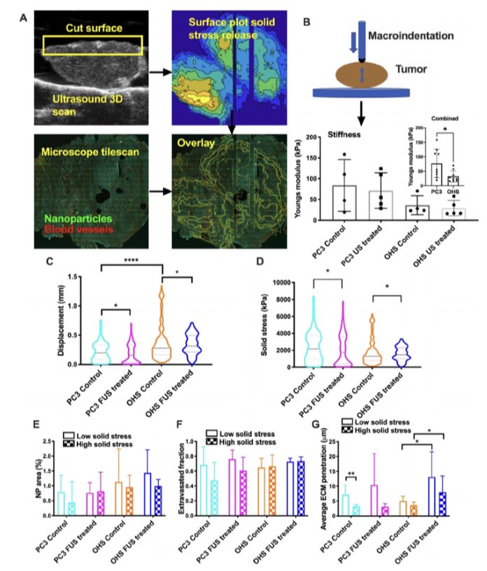 Very happy to share our article in Advanced Therapeutics where we looked at how solid stress in tumors affect nanomedicine delivery and how ultrasound and microbubbles can help overcome this barrier. onlinelibrary.wiley.com/doi/full/10.10…