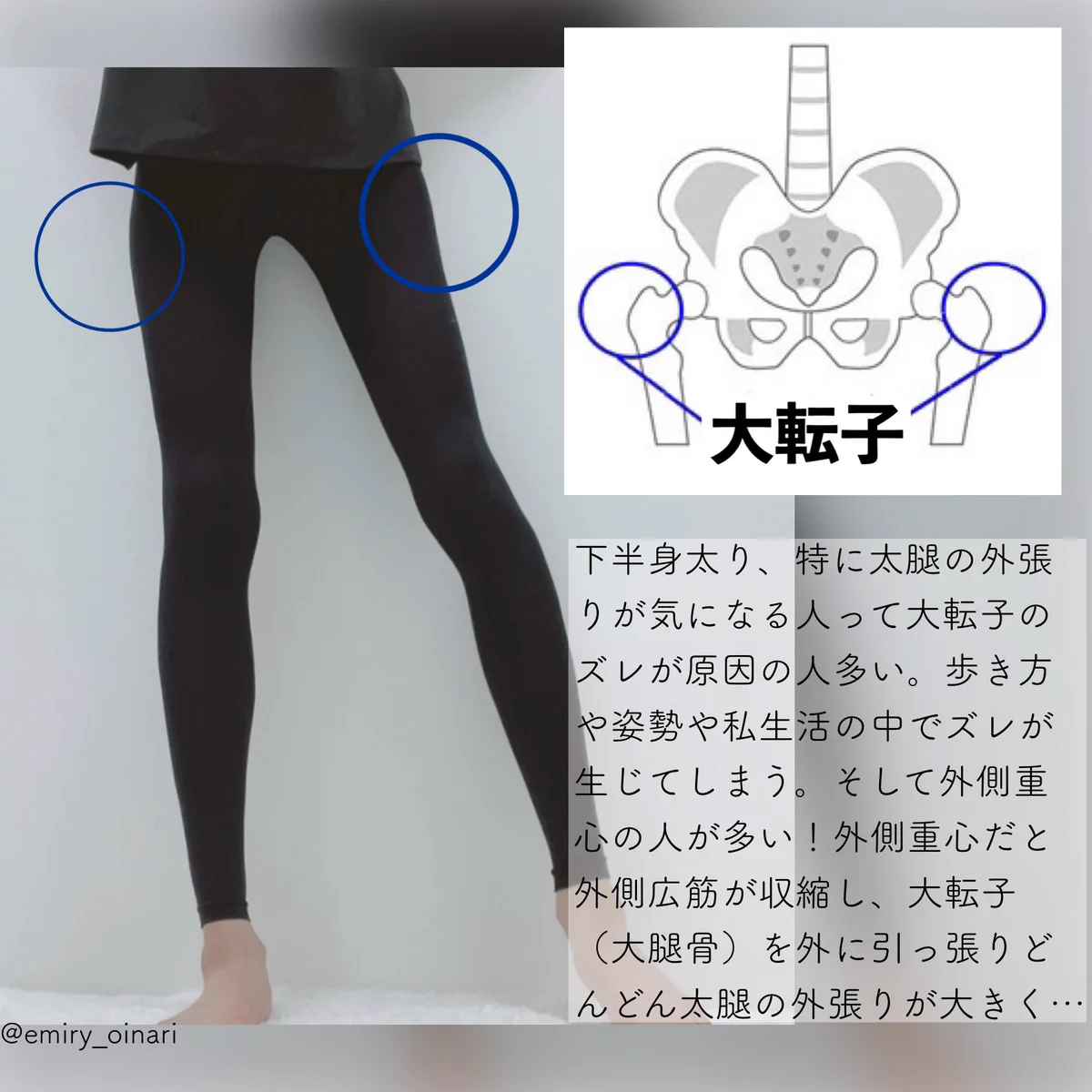 太ももの外側やふくらはぎが張っている方におすすめ！お家で出来るストレッチ方法をご紹介！
