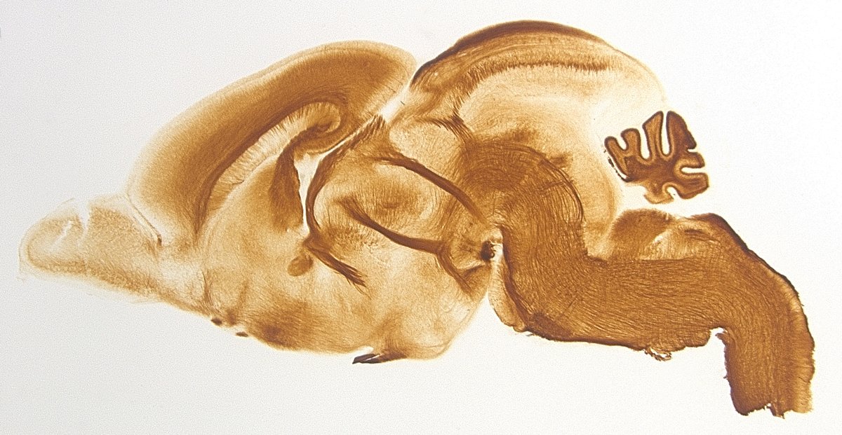 #SciencePhoto_IN
"Fibras cruzando" 
Autora: Verónica Company <a href="/Verito0o0/">Verónica Company</a>
Lab: Dr. Salvador Martínez <a href="/SalvaMP1961/">Salvador Martinez</a> Dr. Diego Echevarría <a href="/DEchevarria_Aza/">Diego Echevarria</a> Dr. Eduardo de Puelles <a href="/edepuelles/">Eduardo de Puelles</a>
 "Distribucion de fibras en una sección sagital de un cerebro de ratón en desarrollo...1/2