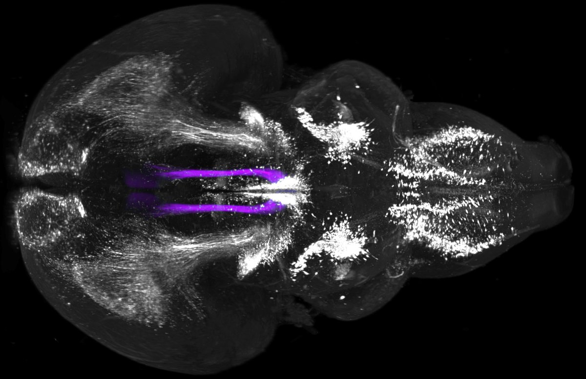 #SciencePhoto_IN
"El tracto retroflejo en el mar dopaminérgico"
Autora: Verónica Company <a href="/Verito0o0/">Verónica Company</a>
Lab: Dr. Salvador Martínez <a href="/SalvaMP1961/">Salvador Martinez</a> Dr. Diego Echevarría <a href="/DEchevarria_Aza/">Diego Echevarria</a> Dr. Eduardo de Puelles <a href="/edepuelles/">Eduardo de Puelles</a>
"Localización 3D del fascículo retroflejo en relación...1/2
