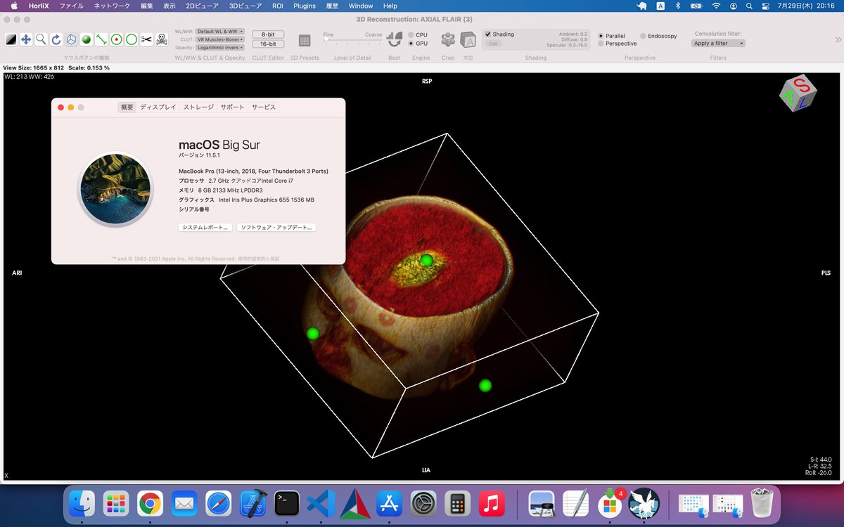 H_Inomata's tweet photo. おかげさまで #HorliX も無事動いてました😅
#apple #BigSur #DICOM https://t.co/pb1j0ib9LW