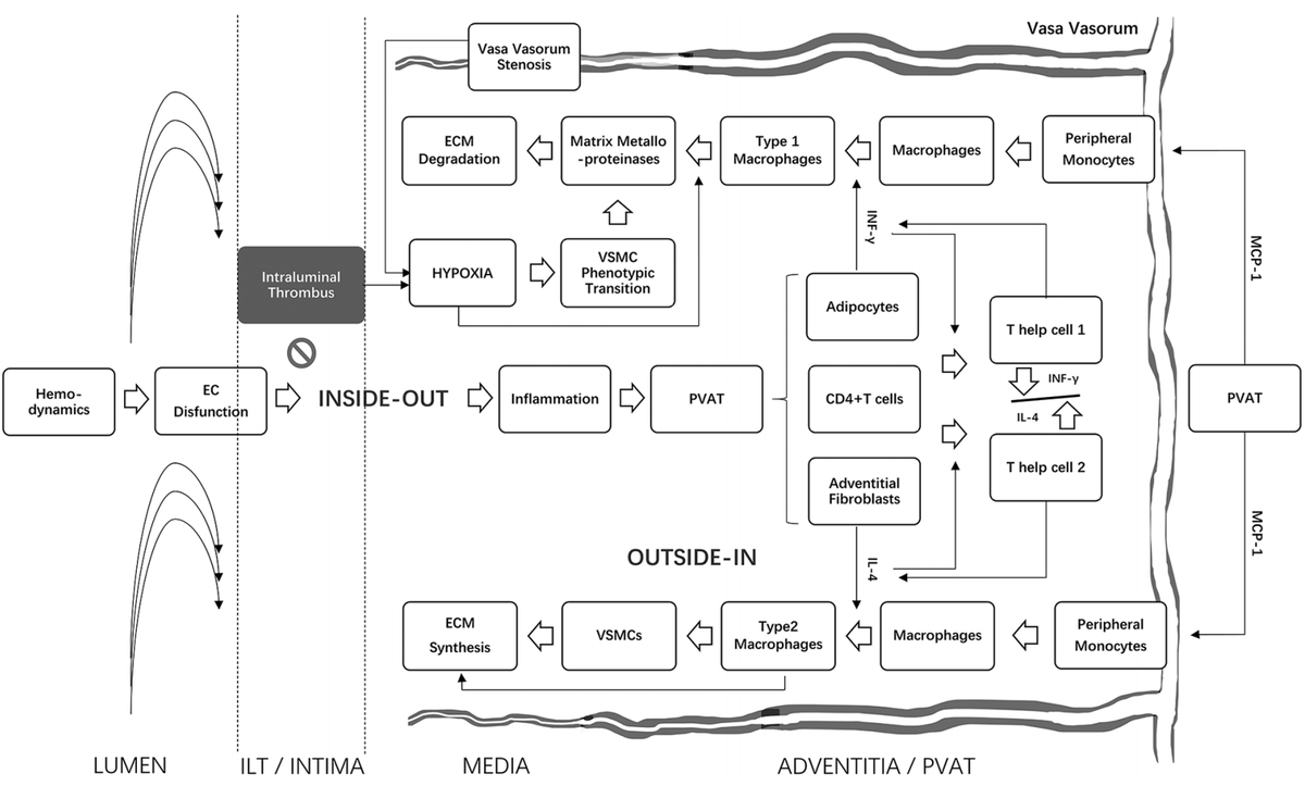 VMJ_SVM's tweet photo. An up-to-date review of the mechanisms of abdominal aortic #aneurysm #AAA progression, involving hemodynamics, perivascular adipose, adventitial fibroblasts, vasa vasorum remodeling, intraluminal thrombus, and macrophage subtypes.

https://t.co/Goj6uEMvCm
#onlinefirst https://t.co/r9x46LWS6F