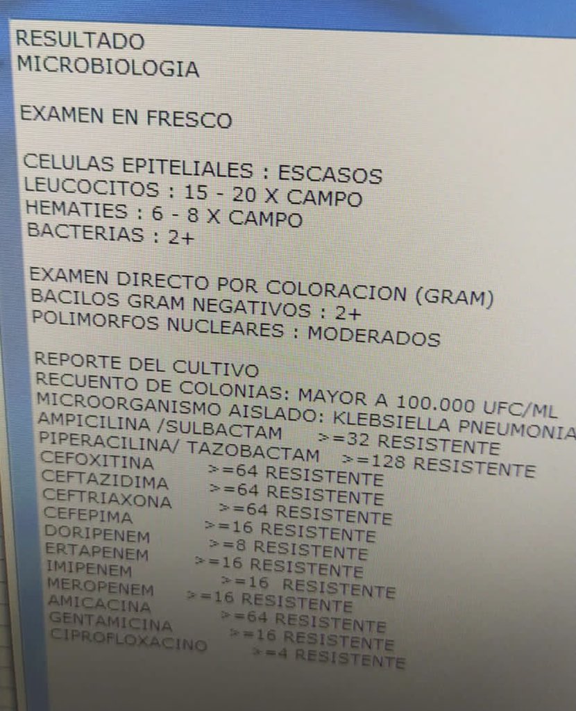 Resultados em Directo