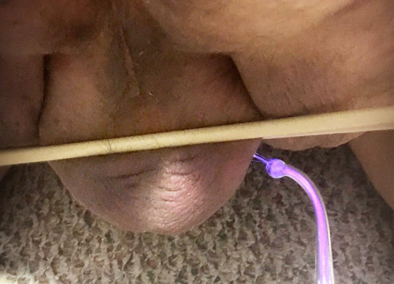 sheyvontabianca's tweet photo. How about a little zap from @MistressJstudio? #SJDomme #electicalplay #painslut https://t.co/xwjJJ6bAZq