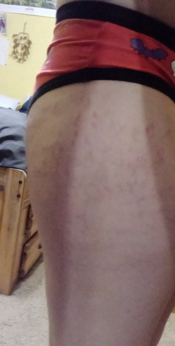 I'm insecure. My stomach pokes put from slouching and weight. I have stretch marks on my thighs. It sucks