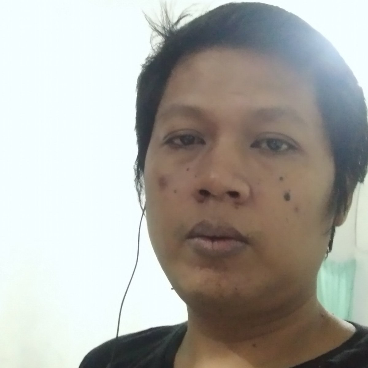 Sehat itu mahal harganya, keluhan saraf terjepit yang sudah cukup parah bisa mengakibatkan kelumpuhan saraf, segera tangani dengan cepat dan tepat info wa 085217275598 untuk panggilan khusus area jateng dan sekitarnya.