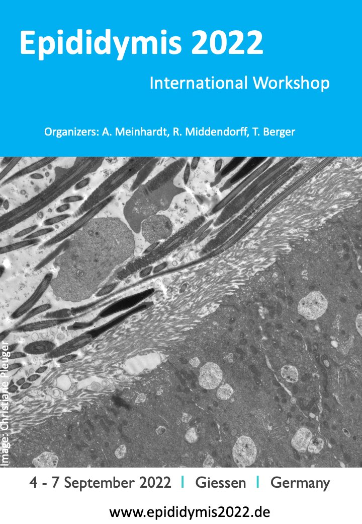 Interested in the epididymis? Here is your meeting . Takes place only in presence.