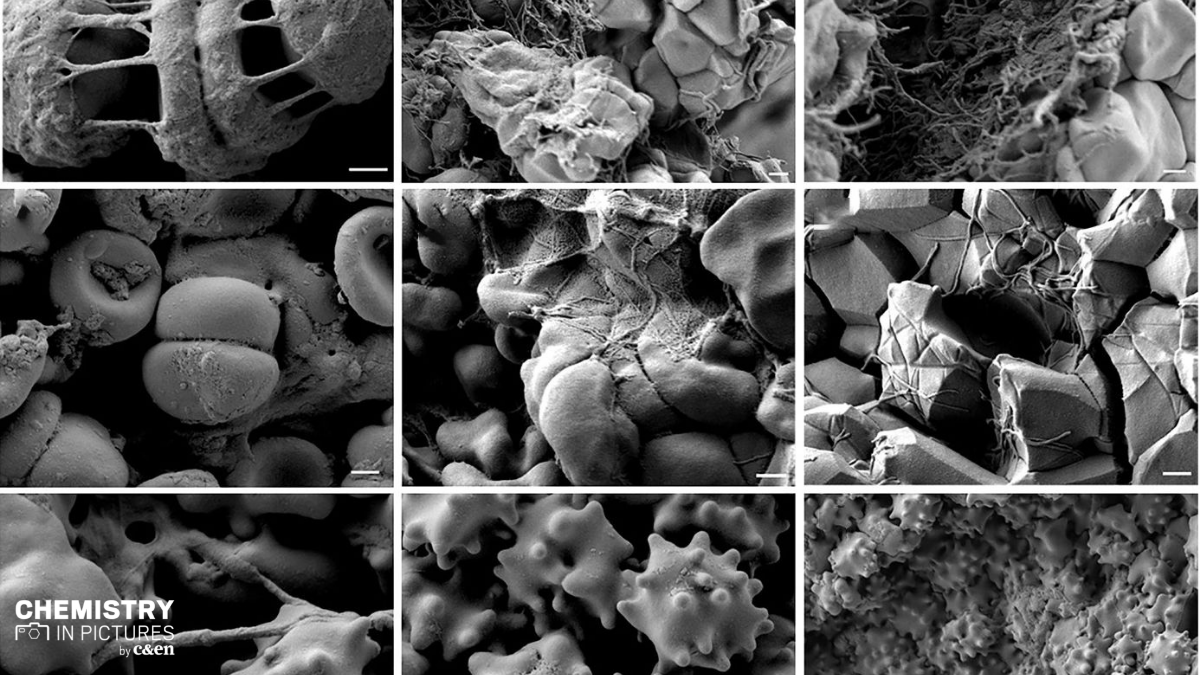 A closer look at clots 🧐 Read about this recent #CENchempics 📸 at fal.cn/3h5xI