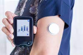 balajis's tweet photo. Becoming Bionic

- fitness trackers
- heart rate monitors
- augmented reality spectacles
- continuous glucose monitors
- smart rings and smart watches
- eventually, brain-machine interfaces

What else we got? https://t.co/OcZIyknAw2