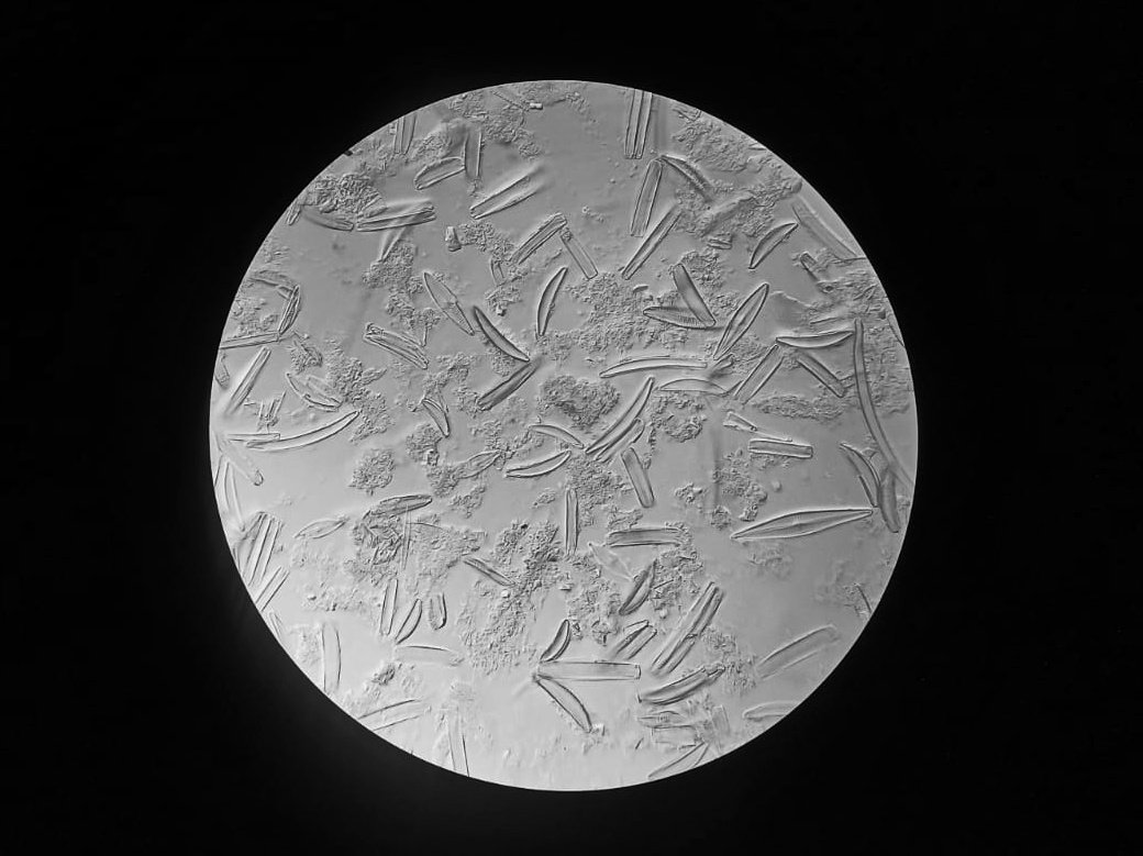 When lovers/astranauts look for the moon, diatomists create their moon🔬
#diatoms #Microscopy #lab #D3 #Eunotia #Gomphonema