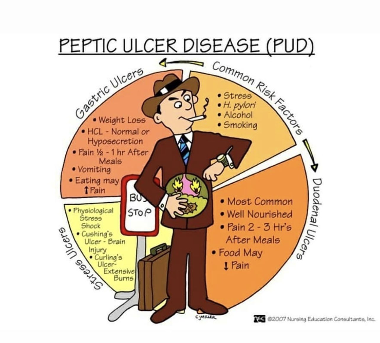 on Twitter "⬇️PEPTIC ULCER DISEASE⬇️ 💡Peptic ulcer disease
