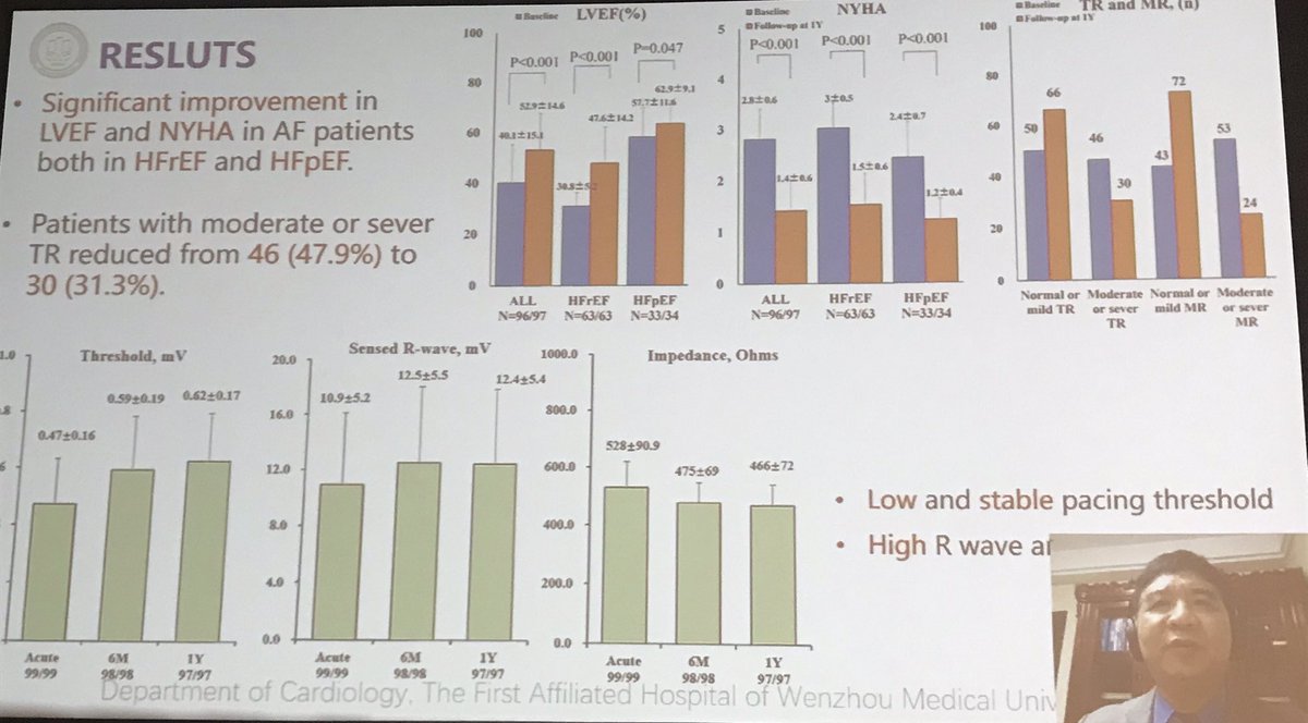 gautamsand's tweet image. The relentless @MdHuang presents his data on HBP/LBBAP in AVN ablation. 
*90% HBP success vs. 100% LBBAP
** Equivalent effect (none) on LVEF
***23 patients switched from HBP to LBBAP for LBBB
****Very low complication rate. 
#HRS2021 #EPeeps @EPeeps_Bot