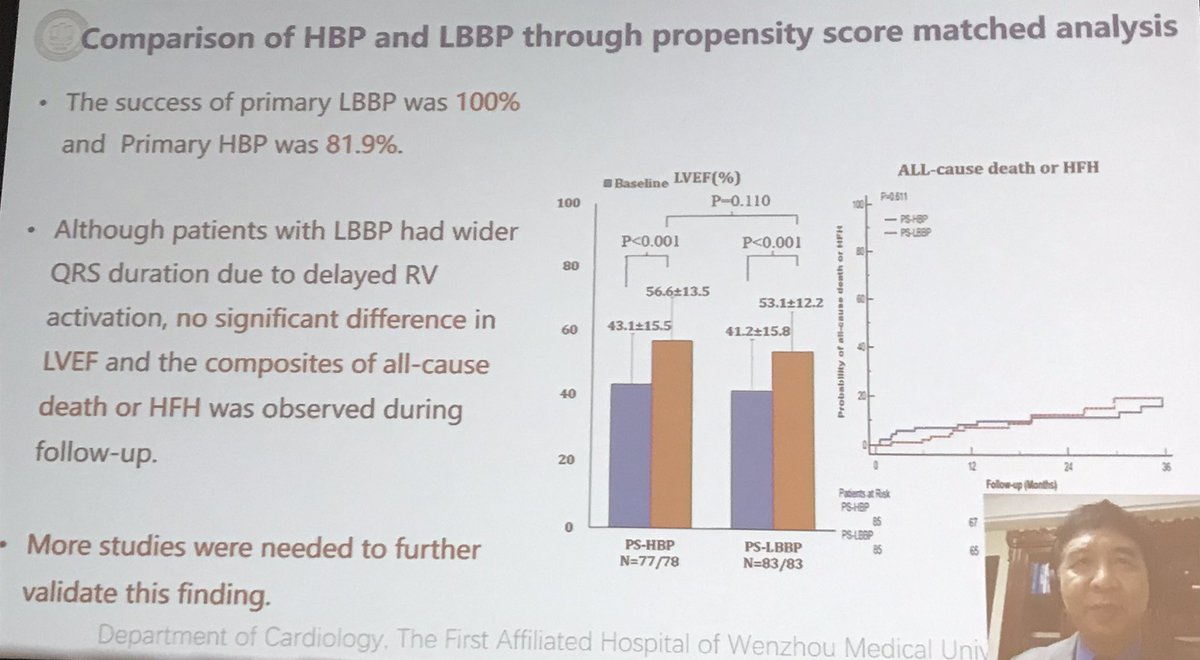 gautamsand's tweet image. The relentless @MdHuang presents his data on HBP/LBBAP in AVN ablation. 
*90% HBP success vs. 100% LBBAP
** Equivalent effect (none) on LVEF
***23 patients switched from HBP to LBBAP for LBBB
****Very low complication rate. 
#HRS2021 #EPeeps @EPeeps_Bot