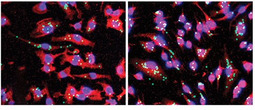 Two new tools for TREM2 research: antisense oligonucleotides and antibody single-chain variable fragments. #alzheimersdisease @WUSTL <a href="/UniofOxford/">University of Oxford</a> ow.ly/cTVo50FGCrS