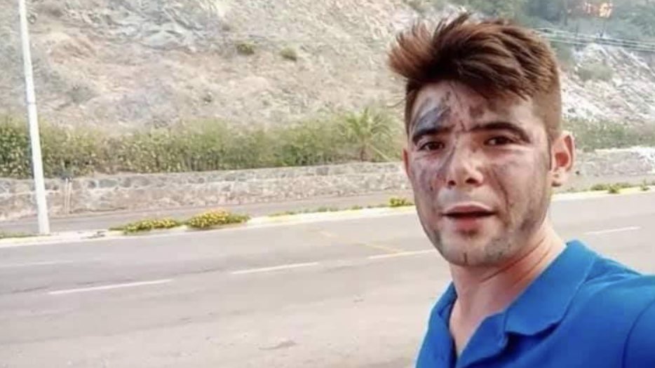 Şahin Akdemir
25 yaşında

Marmaris’te yangın söndürme ekiplerine motoruyla su ve ayran taşırken hayatını kaybetti. 

Unutmayalım
#sahinakdemir