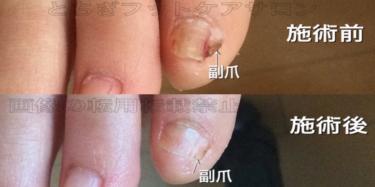 とちぎフットケアサロン Fuss04tochigi Twitter とちぎフットケアサロン Fuss04tochigi Twitter