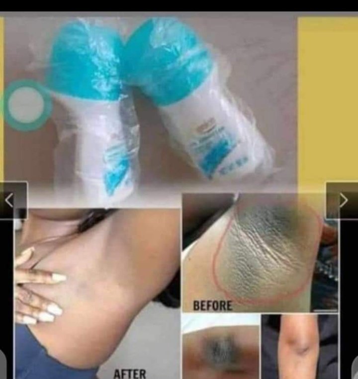 Beebahtt's tweet photo. Dark Armpits-------------
Do you know anyone that has it?
Would you love to help the person get it cleared?
If yes, then reach out to me, you will be amazed at the result.
#BBNajia
#AmazingProduct
#WeWorkWhatWorks https://t.co/uvVqzRHuNh