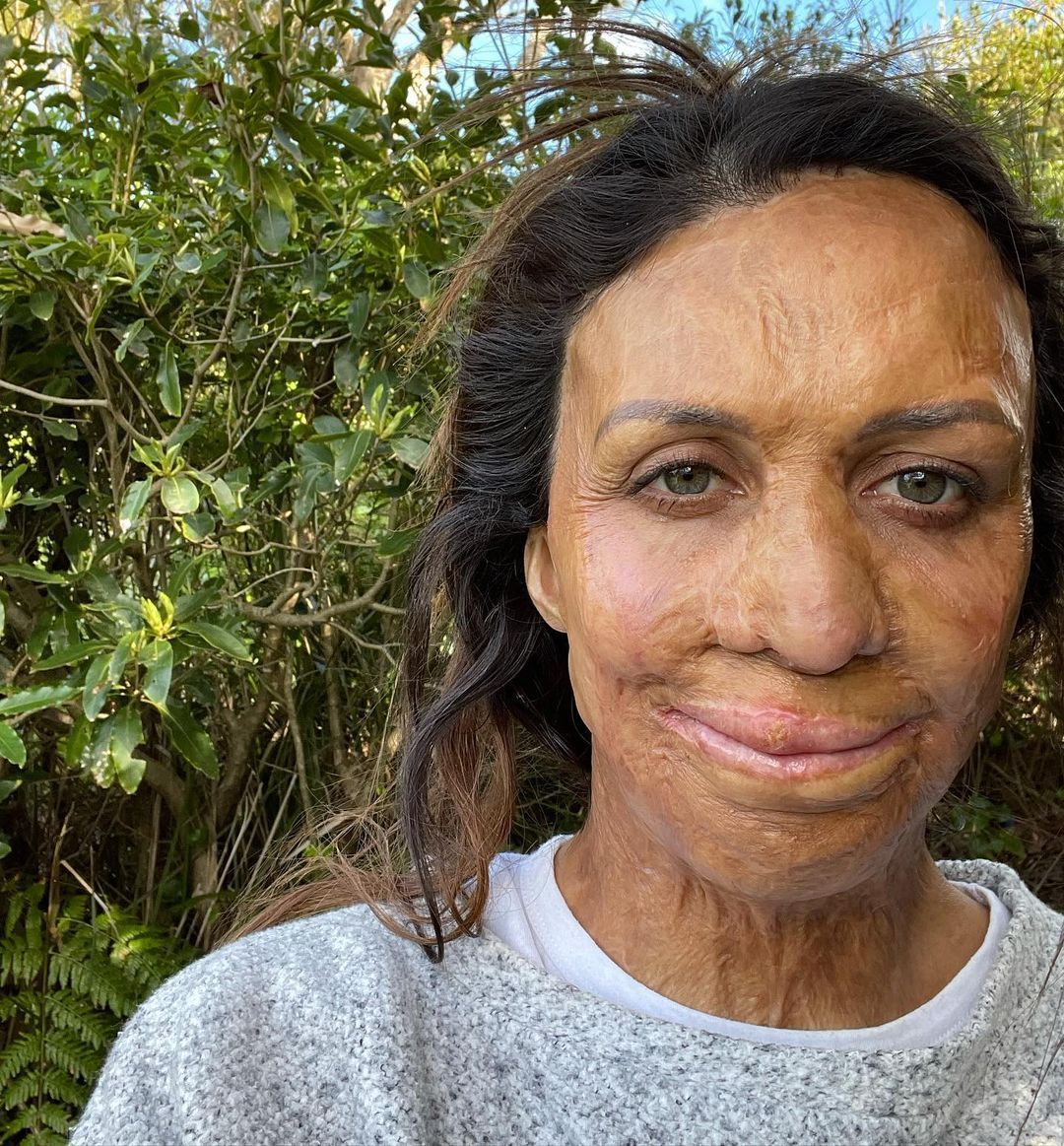 A photo of Turia Pitt.