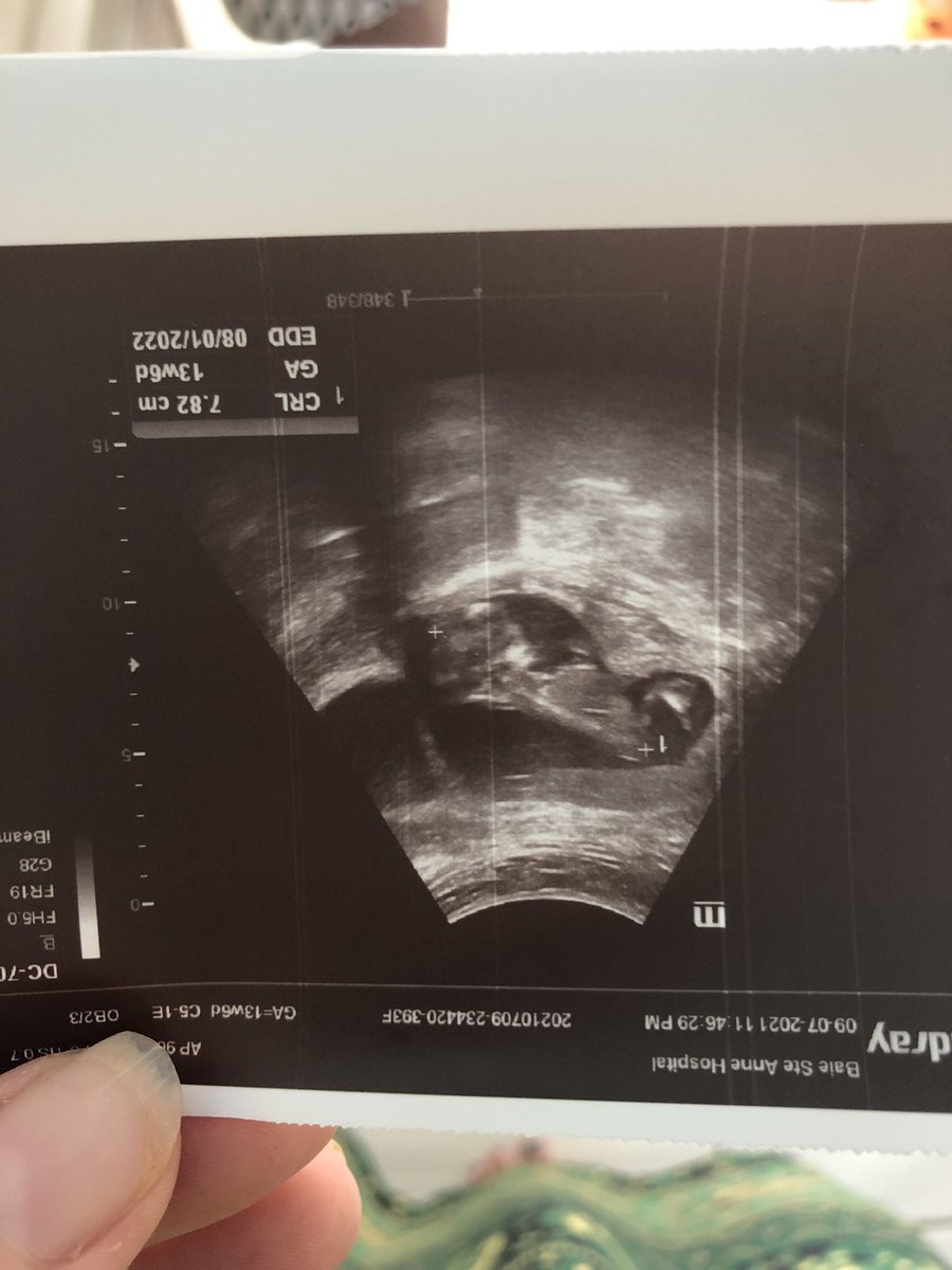 It’s been a pretty awesome year so far and now I have even more to look forward to in 2022! 🥰🥰 #babyonboard