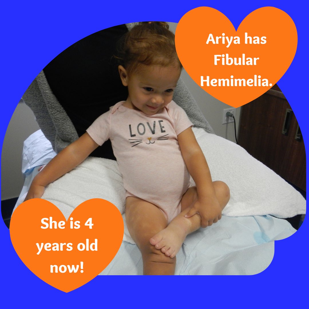 WalkTallGala's tweet photo. Meet Ariya, the sweetest and happiest girl!🌸
We are so excited to say that she had her frame removed last week and her leg bone has grown 8cm!
We thank Ariya for being our patient and we hope that she will always Walk Tall! ❤️
#BCCHR
#BCCH
#UBCOrthopaedics
#Patients https://t.co/9NZEEKeG9l
