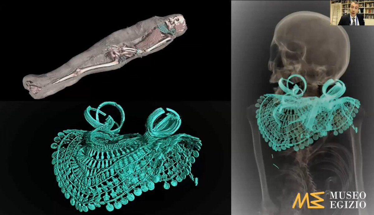 CanMusHistory's tweet photo. Observe fascinating CT scanning techniques as you go behind the scenes at @MuseoEgizio. See museum staff study mummies and reveal their hidden treasures.
📽️ https://t.co/1ilbr27MX1
🎫 ➡️ https://t.co/ZuwKFQhxOm
#QueensOfEgypt https://t.co/QYtal1ijba