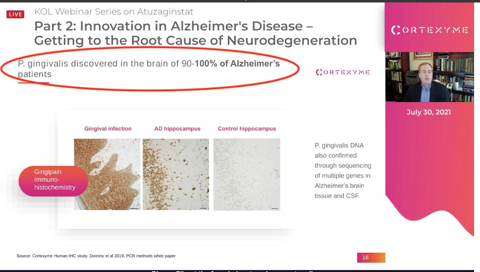 slay_ad's tweet image. "P. gingivalis discovered in the brain of 90-100% of Alzheimer's patients." 

$CRTX #Cortexyme #AAIC21 

#ENDALZ 

Game-changer.