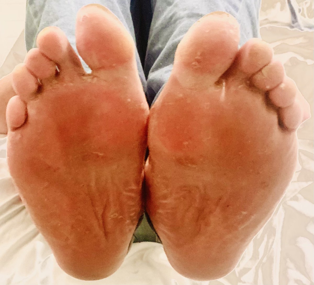 FeetMessy's tweet photo. Sole Friday. 🦶🏻🙂 feet, #toes, #solesfetish, #feetpics, #feetpicsforsale #solesfeet, #wrinkledsoles, #feetvideosforsale, #feetworship https://t.co/CWxMVfHYej