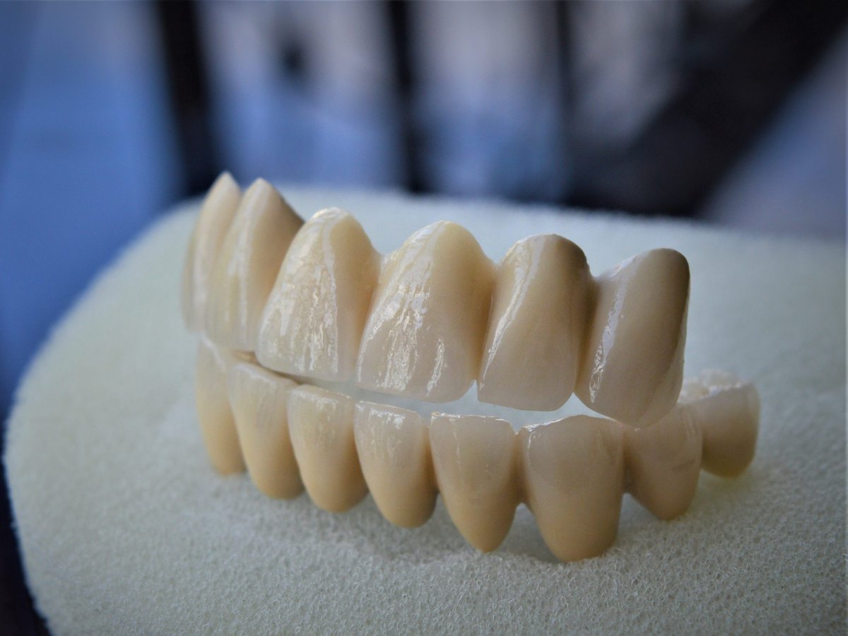 HighEndDental's tweet photo. Restore your smile to the way you remember it! Contact the experts at High End Dental Lab.

#HighEndDentalLab #HighEndDentists #DentalLabs https://t.co/VeBOV6pjJr