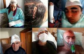 Mam89774282's tweet photo. من #عفرين و #تل_أبيض و #رأس_العين الى #قونيا 
أمام مرئ ومسمع العالم الجلاد اردوغان والضحايا كرد ...

#KonyadaKatliam https://t.co/UfizQj3dWT
