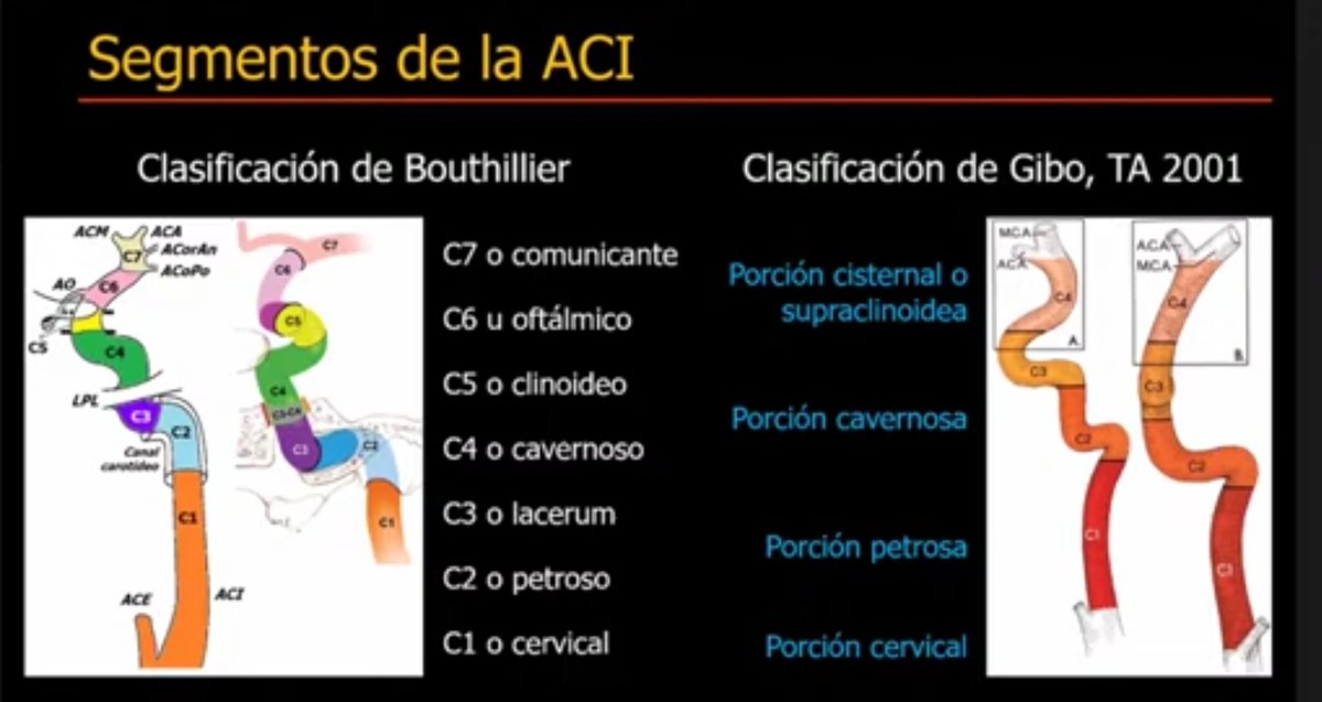 GeovannyCanar's tweet photo. ARTERIA CARÓTIDA INTERNA.

7 segmentos.
Según BOUTHILLIER. https://t.co/hrnQG6k8KV