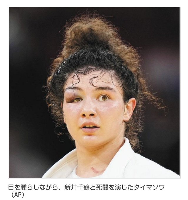 東京五輪 柔道 Rocタイマゾワ選手 目の痣が広がってて痛々しいと話題に 目のまわりの内出血広がってるし まとめダネ