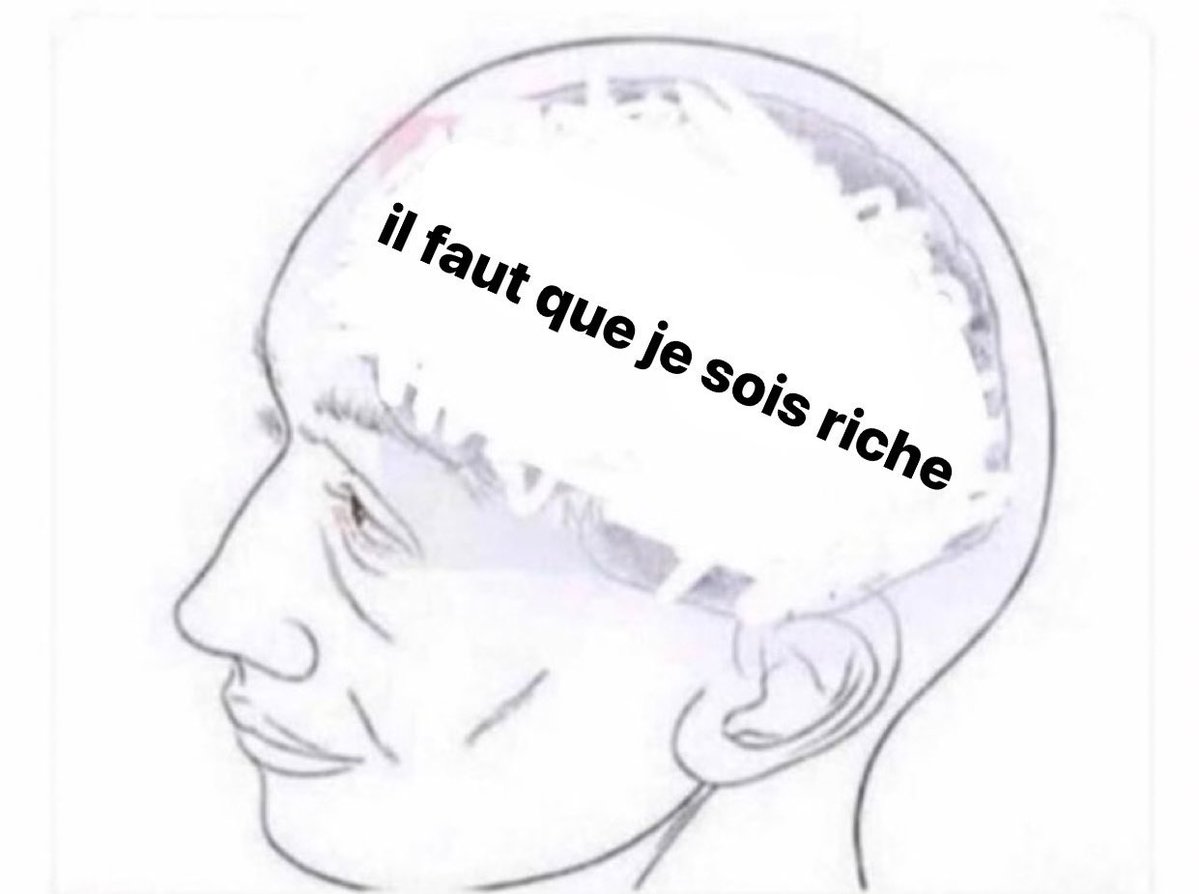 ily44s's tweet image. « Avoue tu penses trop à moi » 

Moi :