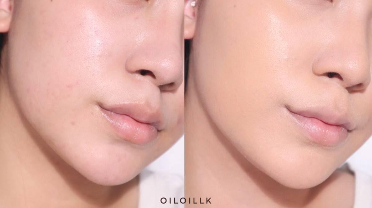 Oiloillkk's tweet image. รองพื้นคุมมันไม่ติดแมสก์ของคนผิวมันก็ต้องหลอดนี้เลย L'Oréal Paris Infallible 24H Matte Cover งานผิวแมทท์ กันน้ำกันเหงื่อเริ่ด ปกปิดดี เนียนไปกับผิวแถมคุมมันได้นาน ไม่ทำให้ผิวอุดตัน ไม่เกิดสิวด้วย ทาแล้วผิวสวยมากกกก #LOrealParisTH #MatteCover #แมททนชัวร์ไม่กลัวสิว