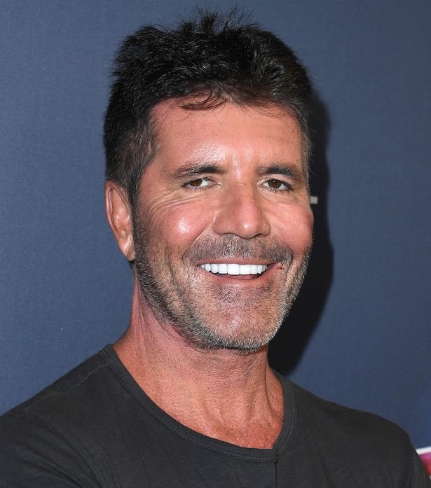 Simon Cowell’s permanently smiling plastic surgery face