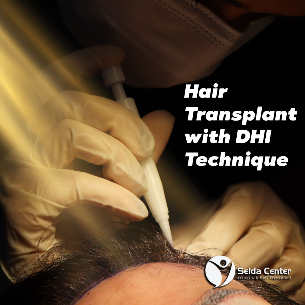 CenterSelda's tweet photo. ▪️In this method, which means Direct #HairTransplantation, grafts are collected by means of a medical pen, which should only be used by specialists.
Again, thanks to this pen, the hair taken is placed directly on the skin without incision or channel opening.
#dhihairtransplant https://t.co/RFZu7B3Mfw
