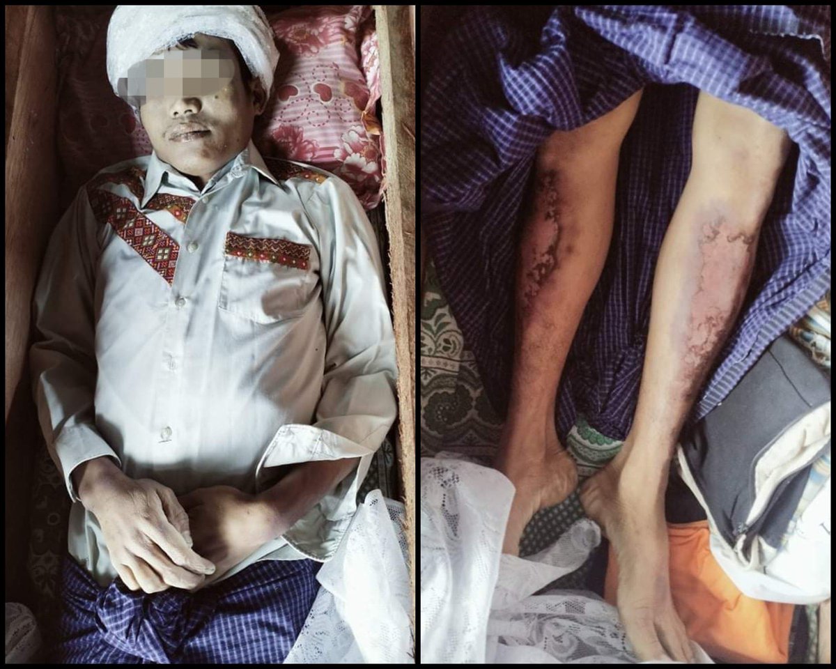 nslwin's tweet photo. KALAY, Sagaing Region:

SAC Terrorists abducted U Lan Khant Thang, 29, lived in Thar Yar Gone village, on July 30 at 11pm along with a car driver. They KILLED him and informed his family today at 9am to retrieve the body.

#July31Coup #WhatsHappeningInMyanmar https://t.co/DhG8FjSLk0