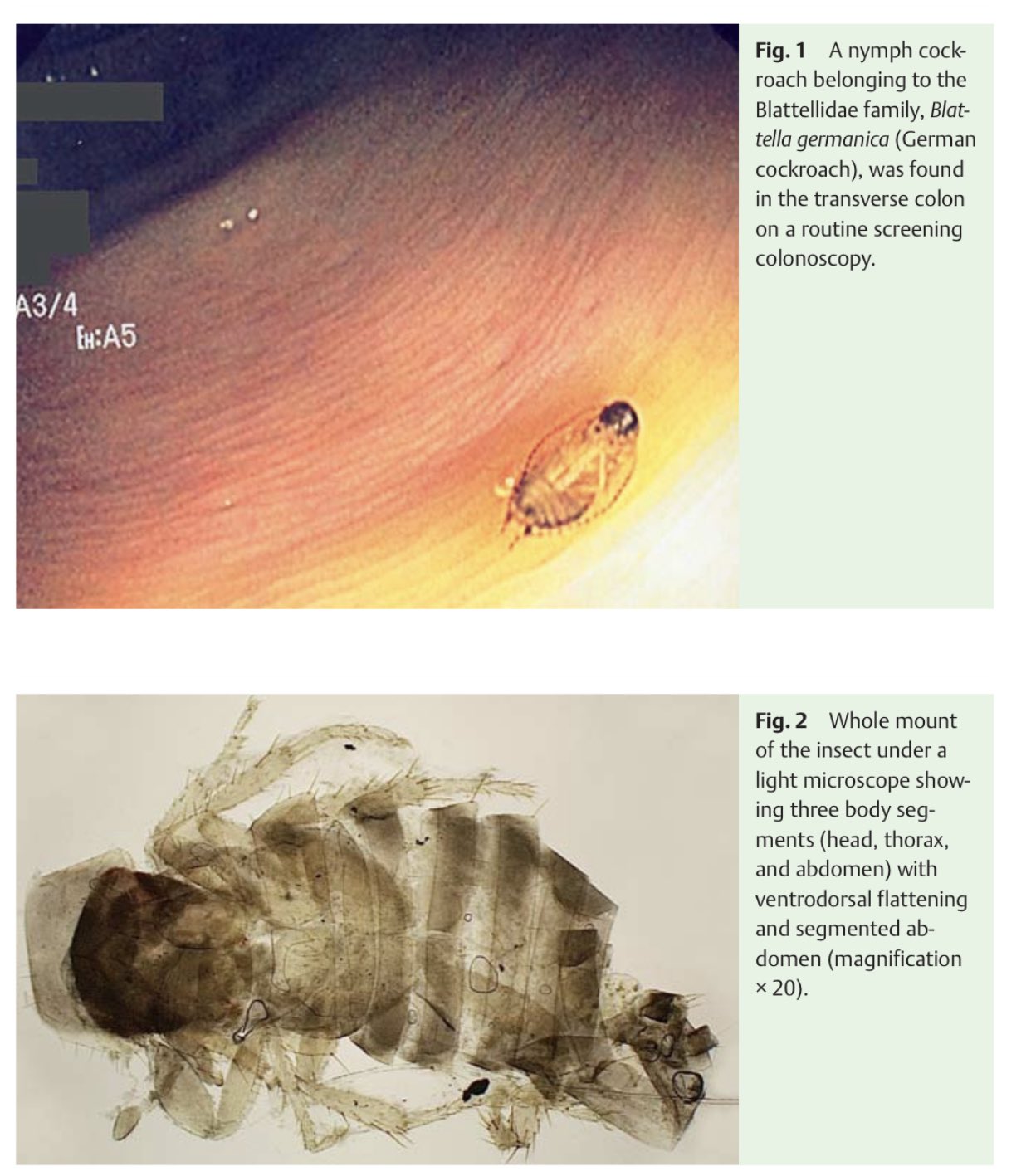 洋書 Insect Histology Amazon.co.jp: Histology - Basic Sciences: 洋書