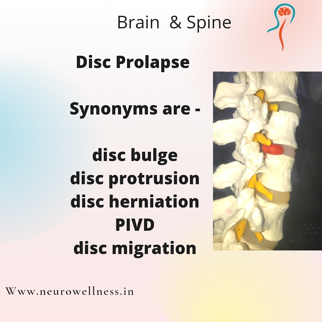 neurowellnes's tweet photo. #neurowellness #Fortishospital #FortisHealthcare #spinehealth #discbulge #backpaintreatment #DiscProblems #DiscProlapse #SpineSurgeon #spinecare https://t.co/ZJRRzVPtpO