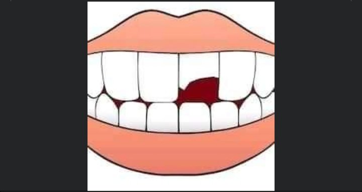 We all have this kinda friends