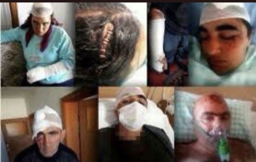 candundaradasi's tweet photo. Dedeoğlu’yuz.
 #HepimizKürdüz https://t.co/xdn3arm7Q3