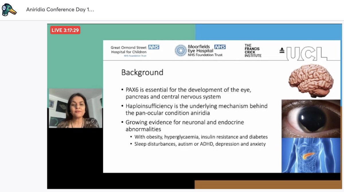 MariyaMoosajee's tweet photo. What a truly inspiring &amp; insightful #EuroAniridiaConf today. Amazing speakers with such informative research. Thrilled to be involved, thanks to @AniridiaNetUK for hosting. Well done to @DLimaCunha for her talk on patient stem cell models. All recorded so do catch up if missed! https://t.co/de4cjTFv2b