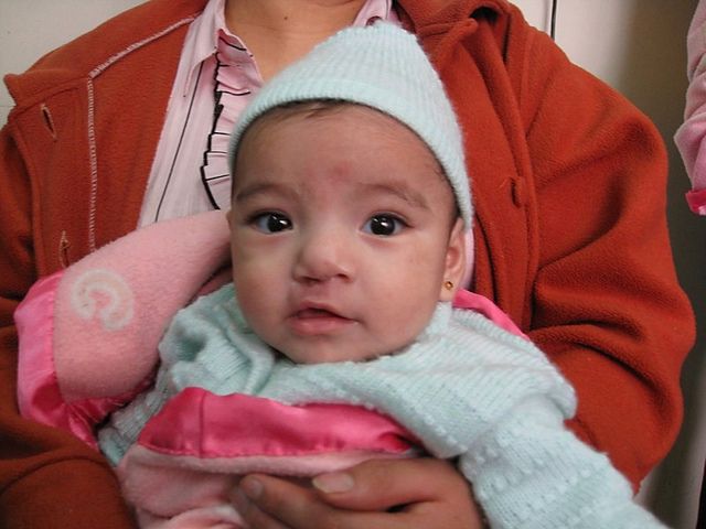 ReSurge's tweet photo. Today is the last day of #CleftAwarenessMonth. It only take a donation of $350 to cover all the costs of a cleft repair. A small price to change a life. Will you help?
https://t.co/APfbQiXzYz
#MakeaDifference
#GlobalSurgery
#SurgeryNotStigma https://t.co/74g5eontXJ