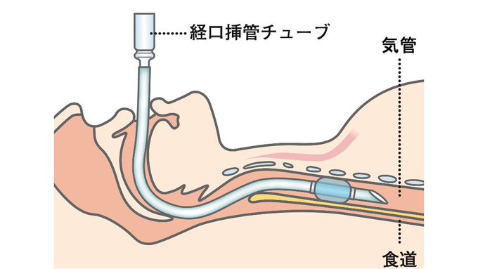 人工呼吸のtwitterイラスト検索結果 古い順