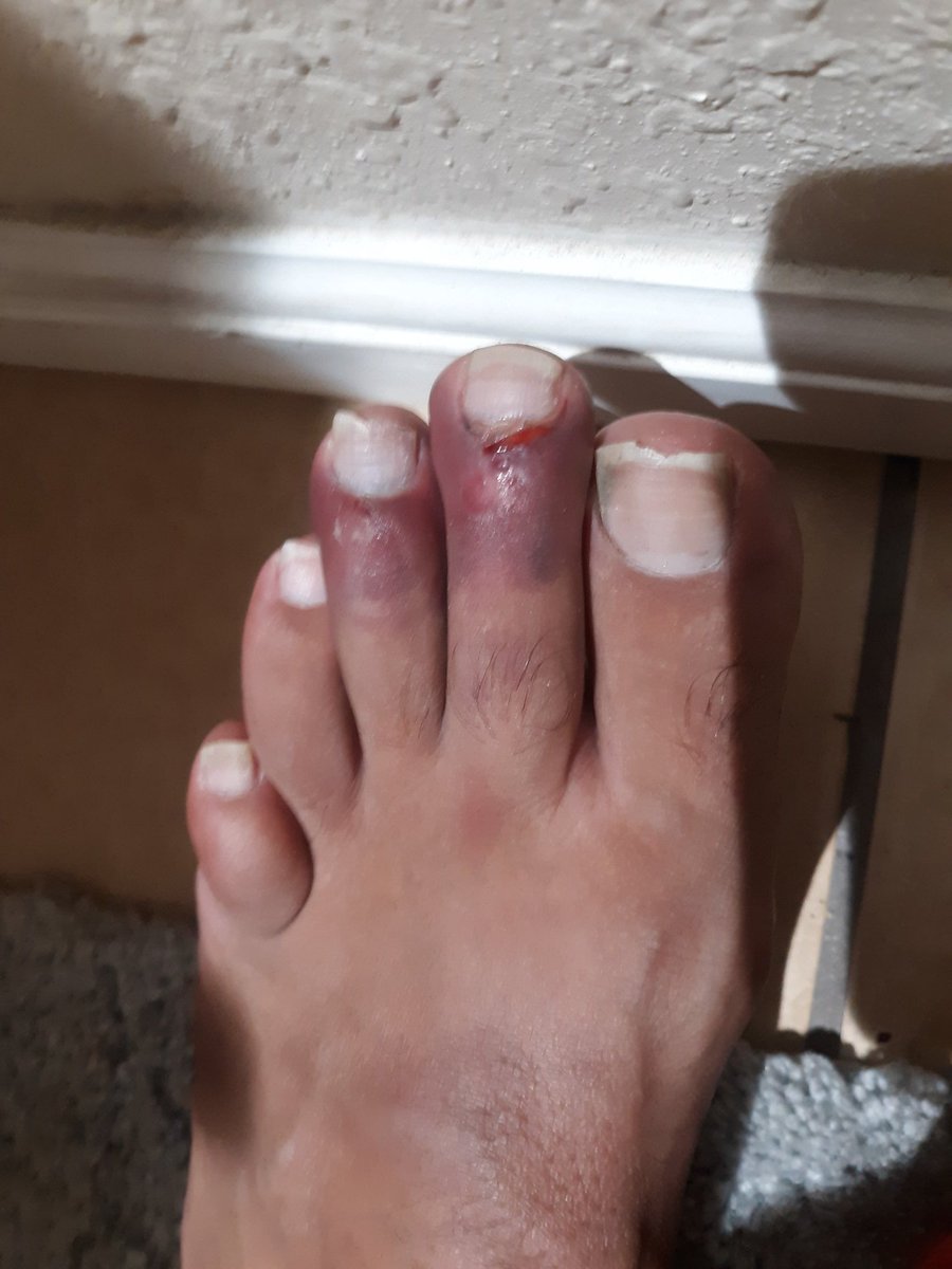 Gotta live it when the engine hatch slams on your foot