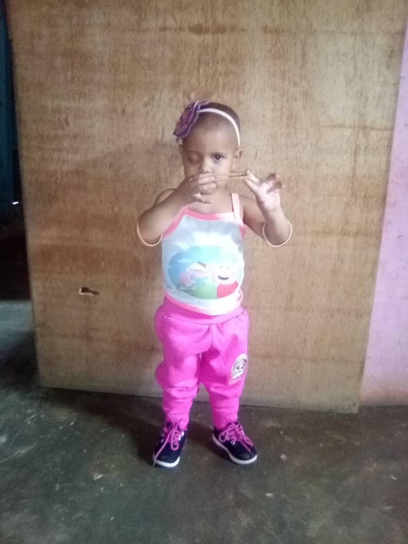 MamaLisVzla's tweet image. #Emergencia nuestros angelitos están recayendo, Jelianny debe ser intervenida urgentemente ya que tiene posible tumor en su ojito izquierdo. La cirugía son $1500.
Y seguimos con la Resonancia de Yondrelis también con posible recaída son $430. Ayuda por favor. Presupuestos 👇👇