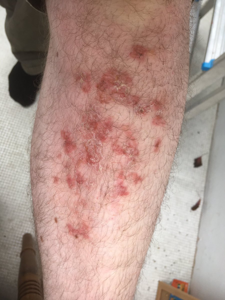 Graeme Lyons tweet media